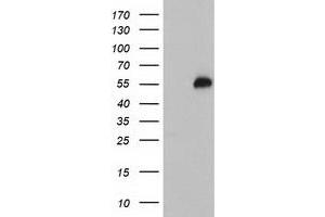Western Blotting (WB) image for anti-Tubby Like Protein 3 (TULP3) antibody (ABIN1501586) (TULP3 Antikörper)