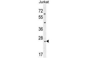 CLDN22 Antibody (Center) western blot analysis in Jurkat cell line lysates (35µg/lane). (Claudin 22 (CLDN22) (AA 97-126), (Middle Region) Antikörper)