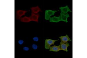ABIN6257650 and ABIN6275616 staining Hela cells(45 min of heat-shock) by IF/ICC. (SYT11 Antikörper  (Internal Region))