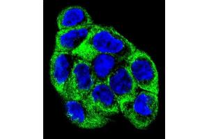 Immunofluorescence (IF) image for anti-ATPase, H+ Transporting, Lysosomal 56/58kDa, V1 Subunit B1 (ATP6V1B1) (AA 284-310) antibody (ABIN655485)