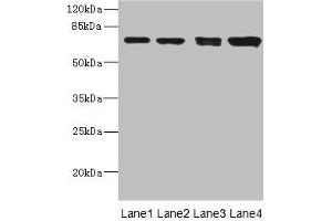 Western blot All lanes: LINGO antibody at 3. (LINGO1 Antikörper  (AA 42-240))