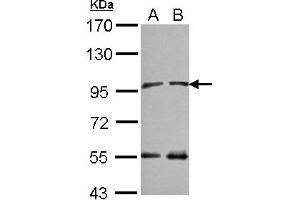 Western Blotting (WB) image for anti-N(alpha)-Acetyltransferase 15, NatA Auxiliary Subunit (NAA15) (C-Term) antibody (ABIN1491819) (NAA15 Antikörper  (C-Term))