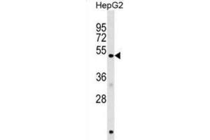 Western Blotting (WB) image for anti-Homocysteine-Inducible, Endoplasmic Reticulum Stress-Inducible, Ubiquitin-Like Domain Member 1 (HERPUD1) antibody (ABIN2999299)