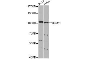 Western blot analysis of extracts of various cell lines, using VCAM1 Antibody. (VCAM1 Antikörper)