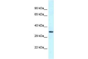 Western Blotting (WB) image for anti-Fibronectin Type III and SPRY Domain Containing 1-Like (FSD1L) (C-Term) antibody (ABIN2788498) (FSD1L Antikörper  (C-Term))