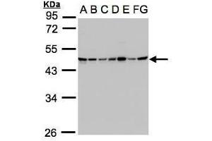 WB Image Sample(30μg whole cell lysate) A: 293T B: A431 , C: H1299 D: HeLa S3 , E: Hep G2 , F: MOLT4 , G: Raji , 10% SDS PAGE antibody diluted at 1:1000 (SUCLG2 Antikörper)