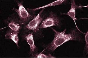Immunofluorescent staining on Human Endothelial cells.