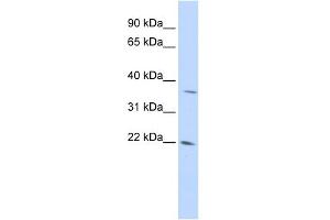 WB Suggested Anti-DDIT4L Antibody Titration: 0. (DDIT4L Antikörper  (Middle Region))