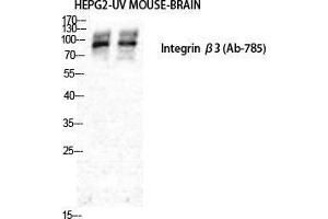 Western Blot (WB) analysis of HepG2 and Mouse Brain cells using Integrin beta3 Polyclonal Antibody. (Integrin beta 3 Antikörper  (Ser63))