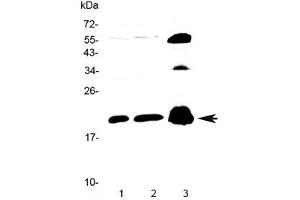 Western blot testing of 1) rat brain, 2) mouse brain and 3) human PANC1 lysate with CPI-17 antibody at 0. (CPI-17 Antikörper)