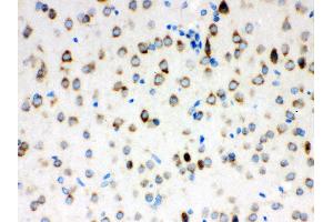 Anti- ATX2 Picoband antibody, IHC(P) IHC(P): Rat Brain Tissue (Ataxin 2 Antikörper  (C-Term))
