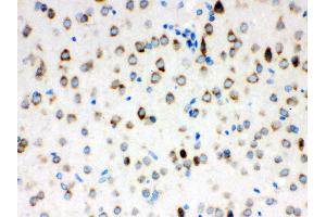 Anti- ATX2 Picoband antibody, IHC(P) IHC(P): Rat Brain Tissue