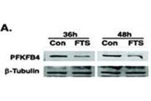 Image no. 2 for anti-6-phosphofructo-2-Kinase/fructose-2,6-Biphosphatase 4 (PFKFB4) (AA 274-303) antibody (ABIN360670) (PFKFB4 Antikörper  (AA 274-303))