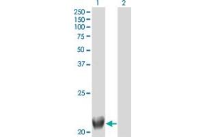 Western Blot analysis of TRIML1 expression in transfected 293T cell line by FLJ36180 monoclonal antibody (M01), clone 4F8. (TRIML1 Antikörper  (AA 369-468))