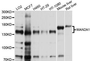 Western blot analysis of extracts of various cell lines, using MAN2A1 antibody. (alpha-Mannosidase II Antikörper  (AA 865-1144))