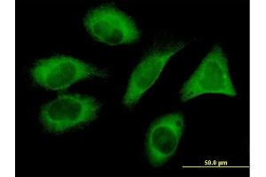 Immunofluorescence of monoclonal antibody to FLJ20643 on HeLa cell. (PIH1D1 Antikörper  (AA 1-290))