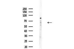 anti-Carcinoembryonic Antigen-Related Cell Adhesion Molecule 20 (CEACAM20) (Internal Region) antibody