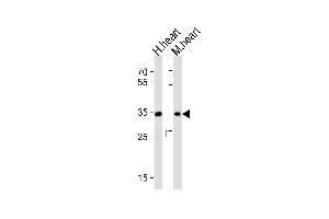 Western blot analysis of lysates from human heart, mouse heart tissue (from left to right), using ASB11 Antibody (N-term) (ABIN1881072 and ABIN2843226). (ASB11 Antikörper  (N-Term))