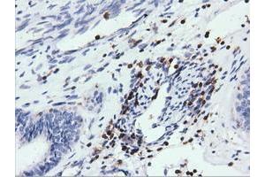 Immunohistochemical staining of paraffin-embedded Human colon tissue using anti-ARHGAP25 mouse monoclonal antibody. (ARHGAP25 Antikörper)