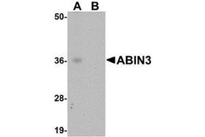 Western blot analysis of ABIN3 in human spleen tissue lysate with AP30005PU-N ABIN3 antibody at 1 μg/ml in (A) the absence and (B) the presence of blocking peptide. (TNIP3 Antikörper  (C-Term))