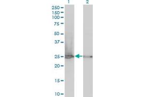 Western Blot analysis of RPL19 expression in transfected 293T cell line by RPL19 monoclonal antibody (M01), clone 3H4. (RPL19 Antikörper  (AA 1-100))