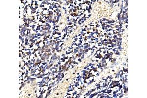 IHC analysis of LSM2 using anti-LSM2 antibody (ABIN7602832).