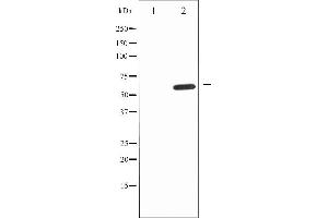 Western blot analysis of IL-10R alpha expression in Na2VO3 treated HepG2 whole cell lysates,The lane on the left is treated with the antigen-specific peptide. (IL-10RA Antikörper  (C-Term))