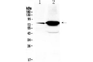 Western blot analysis of FSH Receptor using anti- FSH Receptor antibody .