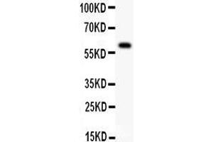 Anti- DR3 antibody, Western blotting All lanes: Anti DR3  at 0. (DR3/LARD Antikörper  (N-Term))