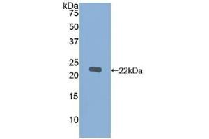 Detection of Recombinant MMP12, Human using Polyclonal Antibody to Matrix Metalloproteinase 12 (MMP12) (MMP12 Antikörper  (AA 290-469))