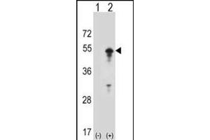 Western blot analysis of ST (arrow) using rabbit polyclonal ST Antibody (D10) (ABIN1882134 and ABIN2839215). (STAM Antikörper  (N-Term))