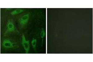 Immunofluorescence (IF) image for anti-Aquaporin 2 (Collecting Duct) (AQP2) (AA 222-271) antibody (ABIN2888757) (AQP2 Antikörper  (AA 222-271))