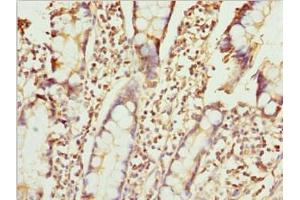Immunohistochemistry of paraffin-embedded human small intestine tissue using ABIN7176126 at dilution of 1:100 (ZNF169 Antikörper  (AA 1-85))