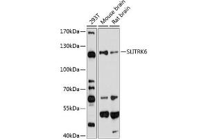 Western blot analysis of extracts of various cell lines, using SLITRK6 antibody (ABIN6130698, ABIN6148072, ABIN6148073 and ABIN6220277) at 1:1000 dilution. (SLITRK6 Antikörper  (AA 621-816))