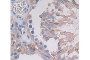 Used in DAB staining on fromalin fixed paraffin- embedded Kidney tissue (TUBE1 Antikörper  (AA 225-472))