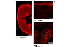 Immunohistochemistry (IHC) image for anti-CD36 (CD36) (N-Term) antibody (ABIN2783229)