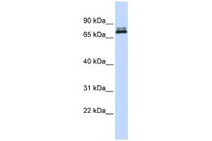 WB Suggested Anti-ASH2L Antibody Titration:  0. (ASH2L Antikörper  (Middle Region))