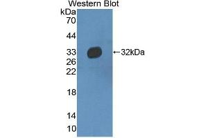 Western Blotting (WB) image for anti-Haptoglobin Related Protein (HPR) (AA 102-347) antibody (ABIN1175340)