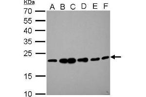 WB Image RAMP2 antibody detects RAMP2 protein by Western blot analysis. (RAMP2 Antikörper  (C-Term))
