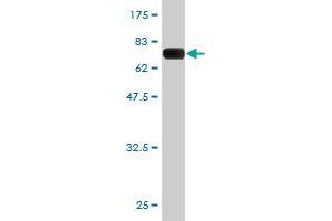 Western Blot detection against Immunogen (65. (PCBP2 Antikörper  (AA 1-362))