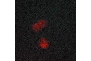ABIN6268758 staining LOVO cells by ICC/IF. (CYP17A1 Antikörper  (Internal Region))