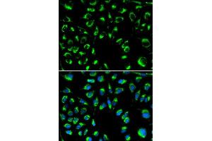 Immunofluorescence analysis of MCF-7 cells using PPP4C antibody (ABIN5971135). (PPP4C Antikörper)