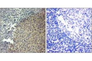 Immunohistochemistry analysis of paraffin-embedded human tonsil tissue, using BLNK (Ab-96) Antibody. (B-Cell Linker Antikörper  (AA 62-111))