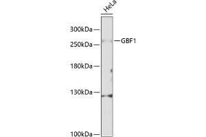 Western blot analysis of extracts of HeLa cells, using GBF1 Antibody (ABIN6132031, ABIN6140994, ABIN6140996 and ABIN6216201) at 1:1000 dilution.