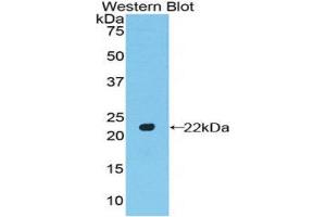 Western Blotting (WB) image for anti-POTE Ankyrin Domain Family, Member G (POTEG) (AA 146-306) antibody (ABIN1171743) (POTEG Antikörper  (AA 146-306))