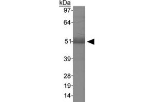 Western blot analysis of MSR1 in human liver using MSR1 polyclonal antibody . (Macrophage Scavenger Receptor 1 Antikörper  (AA 300-400))