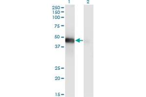 Western Blot analysis of LHX9 expression in transfected 293T cell line by LHX9 monoclonal antibody (M08), clone 1D8.