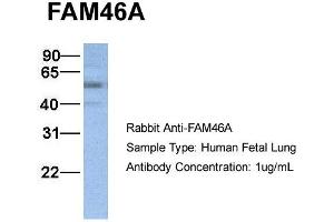 Host:  Rabbit  Target Name:  FAM46A  Sample Type:  Human Fetal Lung  Antibody Dilution:  1.