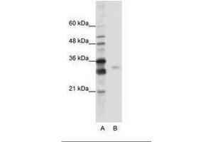 Image no. 1 for anti-serine/arginine-Rich Splicing Factor 1 (SRSF1) (AA 161-210) antibody (ABIN6736207) (SRSF1 Antikörper  (AA 161-210))