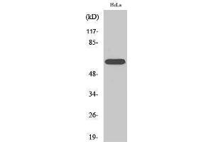 Western Blotting (WB) image for anti-RAR-Related Orphan Receptor A (RORA) (N-Term) antibody (ABIN3177293) (RORA Antikörper  (N-Term))